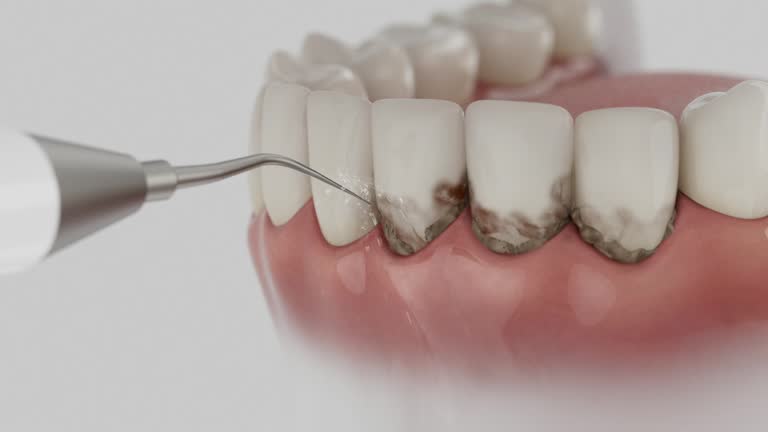 Reliable Tooth Extraction contractor in Brenham, TX by Smile Center Dentistry